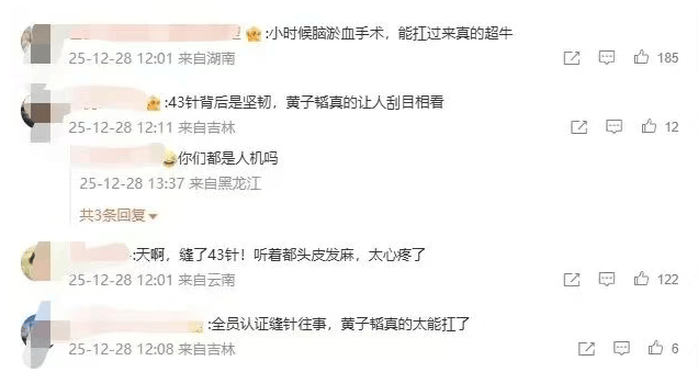 正版皇冠信用网代理_冲上热搜！黄子韬因脑淤血接受开颅手术缝了43针正版皇冠信用网代理，本人回应